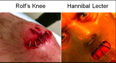 hannibals knee.png